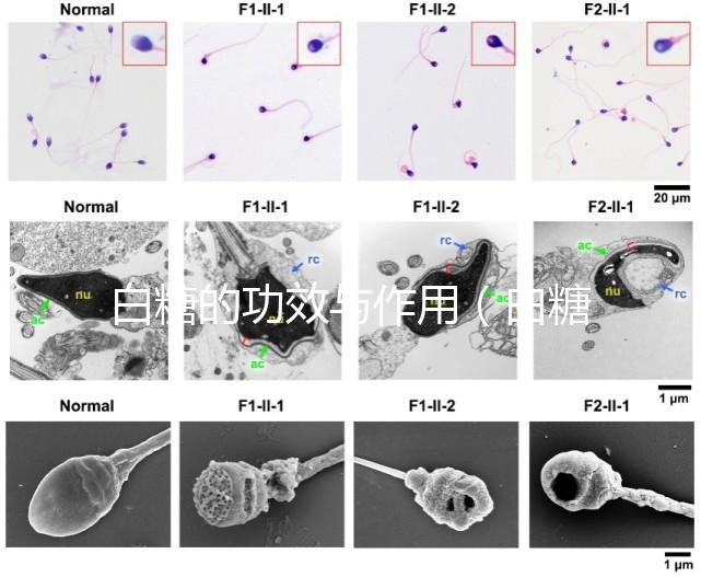 白糖的功效與作用(白糖的功效與作用及營養(yǎng)價值)