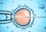 美國(guó)試管嬰兒安全可靠嗎？了解基本原理和安全性？