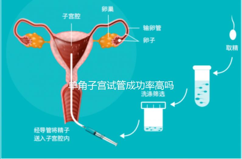 單角子宮試管成功率高嗎？送你5招降低胚胎著床的難度
