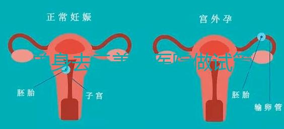 單身去三美泰醫院做試管需要花費多少錢？費用明細是怎么樣的