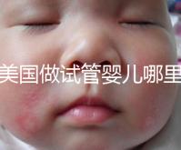 去美國做試管嬰兒哪里最好,4家好評輔助生殖機構推薦