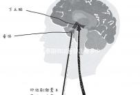 去泰國做試管嬰兒要多少錢(去泰國做試管嬰兒要多少錢泰幣)