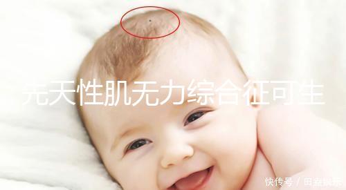 先天性肌無力綜合征可生育嗎？能做試管避免遺傳？