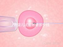 做嬰兒試管需要多少錢