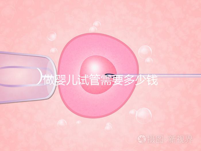 做嬰兒試管需要多少錢(qián)