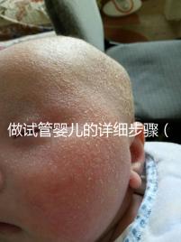 做試管嬰兒的詳細步驟（做試管嬰兒的詳細步驟是什么？）