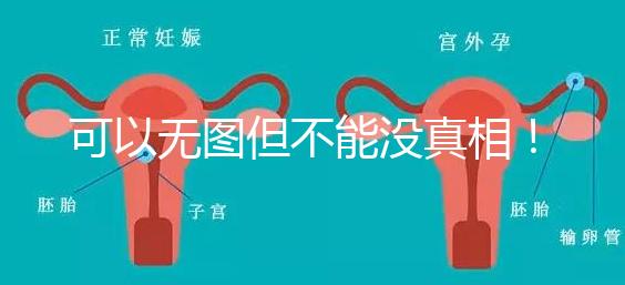 可以無(wú)圖但不能沒(méi)真相!段濤大夫帶你了解B超檢查報(bào)告單