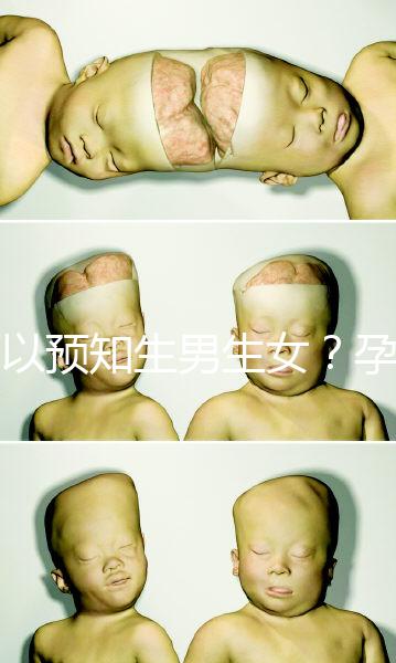 可以預(yù)知生男生女？孕婦夢見馬的胎夢解讀