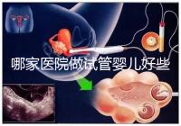 哪家醫院做試管嬰兒好些？