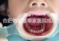 合肥做試管哪家醫(yī)院成功率最高(合肥做試管哪家醫(yī)院成功率最高的)