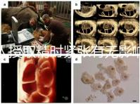 人授取精時緊張有無影響別還不造，注意事項不少不可不知