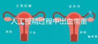人工授精過程中出血需重視！這3種情況會影響成功率