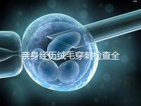 親身經歷絨毛穿刺檢查全過程分享，預約掛號是第一步