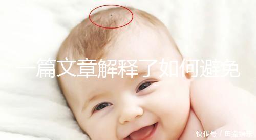 一篇文章解釋了如何避免自然分娩拉大便的尷尬，是否需要開塞露看醫生