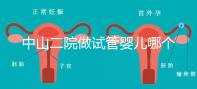 中山二院做試管嬰兒哪個醫(yī)生好？附醫(yī)院試管成功率