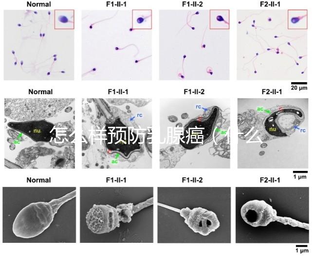 怎么樣預防乳腺癌（什么人容易得乳腺癌）