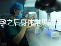 懷孕之后身體常見的表現(xiàn)是什么