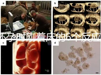 懷孕時(shí)剛著床的6個(gè)反應(yīng),同房后這個(gè)時(shí)候觀察身體最準(zhǔn)