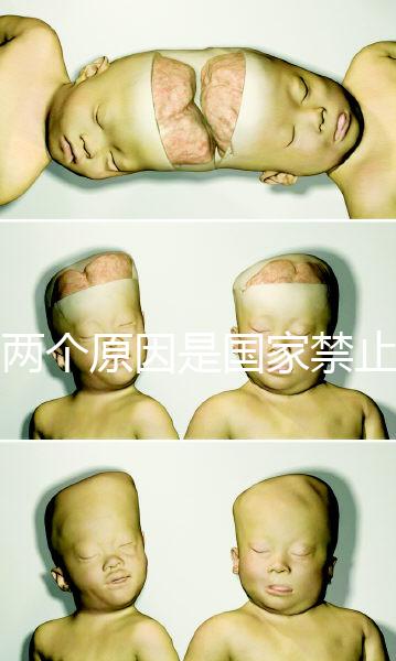 有兩個原因是國家禁止中非混血中國會接受嗎？