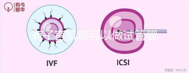 有子宮肌瘤可以做試管嬰兒?jiǎn)幔ㄓ凶訉m肌瘤可以做試管嬰兒?jiǎn)岫嗌馘X(qián)）