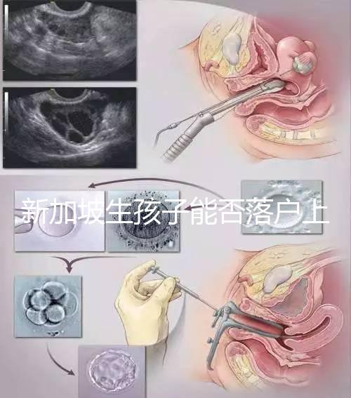 新加坡生孩子能否落戶上海分，@家長:高學(xué)歷可以申請