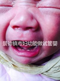 景德鎮市婦幼能做試管嬰兒嗎？江西這些地區是熱門選擇