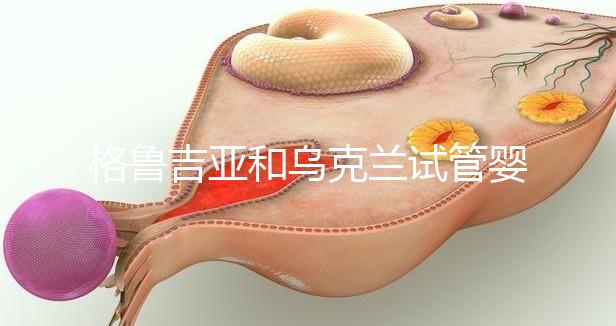 格魯吉亞和烏克蘭試管嬰兒那個好?看到這些原因就一目了然