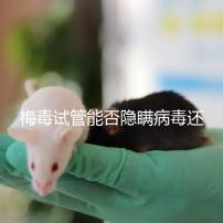 梅毒試管能否隱瞞病毒還沒(méi)有建造，備案記錄已經(jīng)通知