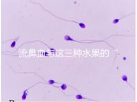 流鼻血與這三種水果的“奇妙”關(guān)系,建議少吃,多補充維生素K可以幫助止血!