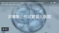 河南第三代試管嬰兒醫院整理,成功率、費用全在這