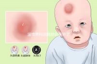 淄博男科醫(yī)院排名表來了2024年哪個口碑好?網(wǎng)友怎么說?