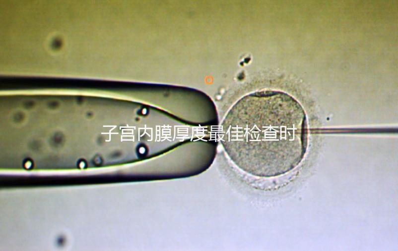 子宮內(nèi)膜厚度最佳檢查時(shí)期，你有必要提前知道！