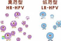 孕前檢查項目有哪些？