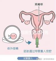 孕檢時b超醫生透露懷男寶女寶暗語寶典，一語戳中有心人！