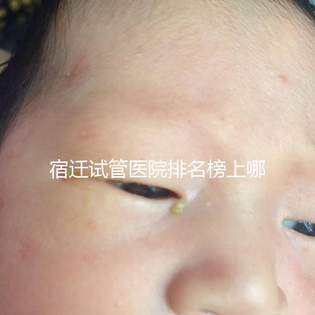 宿遷試管醫(yī)院排名榜上哪家好,不造助孕成功率和費用別亂選