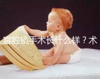 宮腔鏡手術(shù)長什么樣？術(shù)后要注意什么？ ?