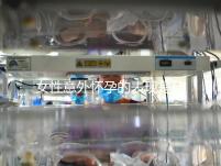 女性意外懷孕的表現(xiàn)是什么?