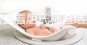 如何查看唐氏篩查結(jié)果,珠海醫(yī)院價(jià)格二百四起