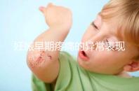 妊娠早期疼痛的異常表現是什么?