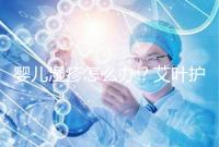 嬰兒濕疹怎么辦？艾葉護理不一定管用，4個小妙招輕松治療