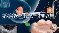 婚檢能查出流產史嗎?帶你詳細解答相關疑惑