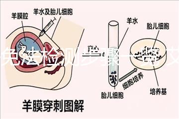酶免法檢測(cè)步驟一覽 艾滋病