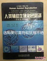 選購美可高特前猶豫不絕，該款羊奶粉品牌質量賣點介紹