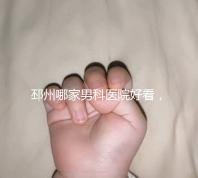邳州哪家男科醫(yī)院好看,這家甲類機構(gòu)居然領(lǐng)先
