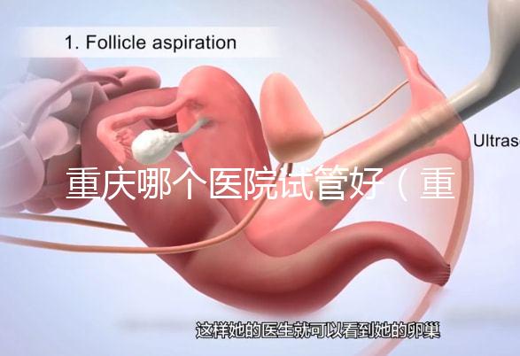 重慶哪個醫院試管好(重慶哪個醫院試管好一點)