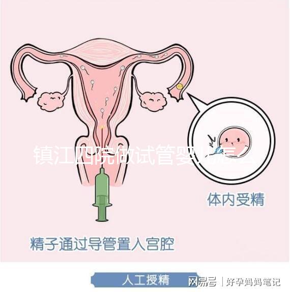 鎮江四院做試管嬰兒怎么樣？具體成功率費用介紹