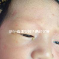 胚胎著床失?。窟x對試管嬰兒醫(yī)生很重要