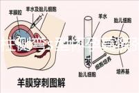 脊柱側彎s型懷孕莫慌張，能否順產還得看這4大要素