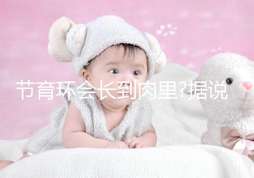 節(jié)育環(huán)會長到肉里?據(jù)說這是有一定依據(jù)的
