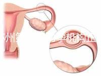 蘇州第三代助孕機(jī)構(gòu)正規(guī)可靠嗎?實(shí)地考察才為真